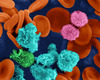 Challenging Questions in Multiple Myeloma